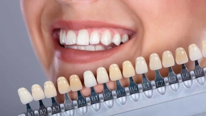teeth whitening for teens summary