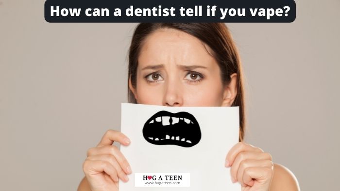 How can a dentist tell if you vape